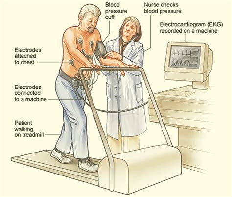 stress test heart for someone who works hard|types of cardiac stress tests.